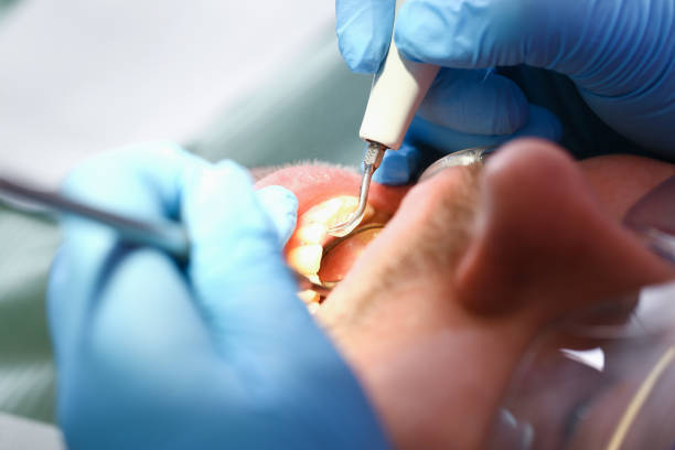 Best Emergency Root Canal Therapy in Rutland, VT