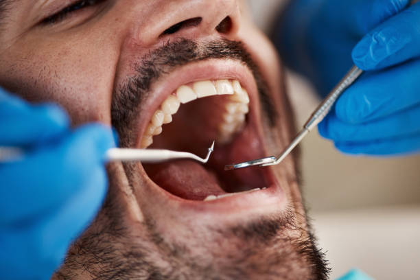 Best Broken or Chipped Tooth Repair in Rutland, VT