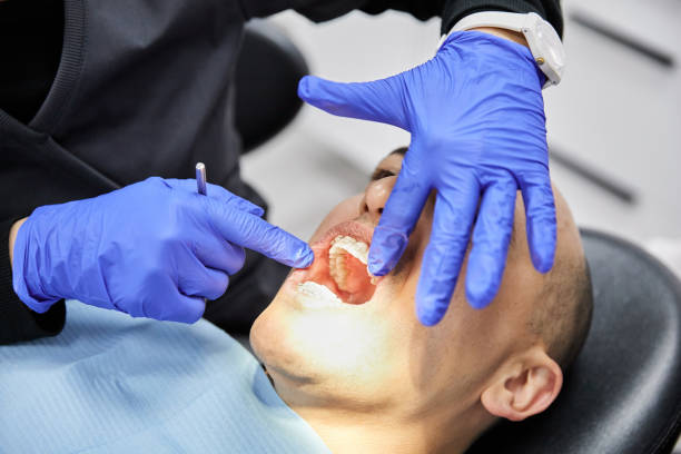 Best Emergency Wisdom Tooth Extraction in Rutland, VT