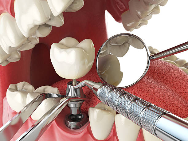 Best Walk-In Emergency Dental Services in Rutland, VT